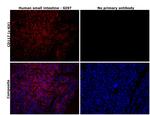 CD117 (c-Kit) Antibody in Immunohistochemistry (Paraffin) (IHC (P))