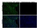 CD117 (c-Kit) Antibody in Immunohistochemistry (Paraffin) (IHC (P))