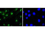 H3R2me1 Antibody in Immunocytochemistry (ICC/IF)