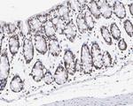 H3R2me1 Antibody in Immunohistochemistry (Paraffin) (IHC (P))