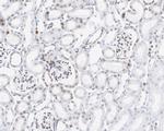 H3R2me1 Antibody in Immunohistochemistry (Paraffin) (IHC (P))