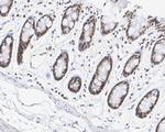 H3R2me1 Antibody in Immunohistochemistry (Paraffin) (IHC (P))