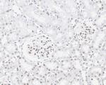 H3R2me1 Antibody in Immunohistochemistry (Paraffin) (IHC (P))