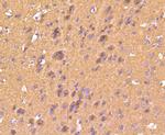 S100B Antibody in Immunohistochemistry (Paraffin) (IHC (P))