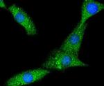 PYK2 Antibody in Immunocytochemistry (ICC/IF)