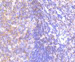 PYK2 Antibody in Immunohistochemistry (Paraffin) (IHC (P))