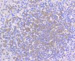 PYK2 Antibody in Immunohistochemistry (Paraffin) (IHC (P))