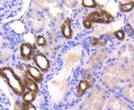 PYK2 Antibody in Immunohistochemistry (Paraffin) (IHC (P))