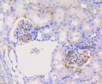 PYK2 Antibody in Immunohistochemistry (Paraffin) (IHC (P))