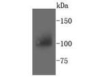 PYK2 Antibody in Western Blot (WB)