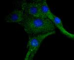 Phospho-PDGFRB (Tyr740) Antibody in Immunocytochemistry (ICC/IF)