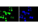 H2BK20ac Antibody in Immunocytochemistry (ICC/IF)