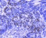 H2BK20ac Antibody in Immunohistochemistry (Paraffin) (IHC (P))