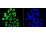 H3K9me2 Antibody in Immunocytochemistry (ICC/IF)