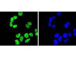 H3K9me2 Antibody in Immunocytochemistry (ICC/IF)