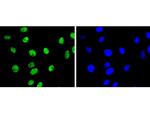 H3K9me2 Antibody in Immunocytochemistry (ICC/IF)