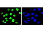 H3K9me2 Antibody in Immunocytochemistry (ICC/IF)