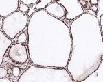 H3K9me2 Antibody in Immunohistochemistry (Paraffin) (IHC (P))