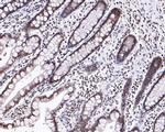 H3K9me2 Antibody in Immunohistochemistry (Paraffin) (IHC (P))