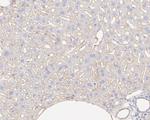 INSR beta Antibody in Immunohistochemistry (Paraffin) (IHC (P))