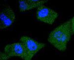 PSA Antibody in Immunocytochemistry (ICC/IF)