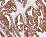 PSA Antibody in Immunohistochemistry (Paraffin) (IHC (P))