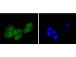 IRS1 Antibody in Immunocytochemistry (ICC/IF)