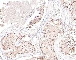 HDAC2 Antibody in Immunohistochemistry (Paraffin) (IHC (P))