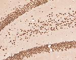 HDAC2 Antibody in Immunohistochemistry (Paraffin) (IHC (P))