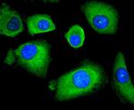 HDAC4 Antibody in Immunocytochemistry (ICC/IF)