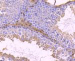 STAT5 beta Antibody in Immunohistochemistry (Paraffin) (IHC (P))