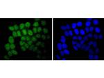 SUZ12 Antibody in Immunocytochemistry (ICC/IF)