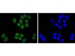 SUZ12 Antibody in Immunocytochemistry (ICC/IF)