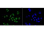 SUZ12 Antibody in Immunocytochemistry (ICC/IF)