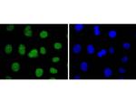 SUZ12 Antibody in Immunocytochemistry (ICC/IF)