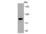 SUZ12 Antibody in Western Blot (WB)