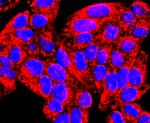 MMP13 Antibody in Immunocytochemistry (ICC/IF)