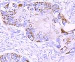 MMP13 Antibody in Immunohistochemistry (Paraffin) (IHC (P))