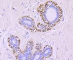 MMP13 Antibody in Immunohistochemistry (Paraffin) (IHC (P))