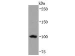 TERT Antibody in Western Blot (WB)