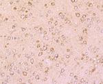 DRD1 Antibody in Immunohistochemistry (Paraffin) (IHC (P))