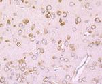 DRD1 Antibody in Immunohistochemistry (Paraffin) (IHC (P))