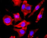 NMDAR1 Antibody in Immunocytochemistry (ICC/IF)