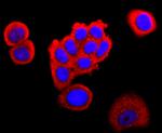 FABP4 Antibody in Immunocytochemistry (ICC/IF)