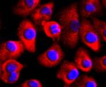 FABP4 Antibody in Immunocytochemistry (ICC/IF)