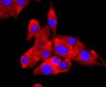 FABP4 Antibody in Immunocytochemistry (ICC/IF)