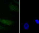 PDCD4 Antibody in Immunocytochemistry (ICC/IF)