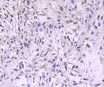 PDCD4 Antibody in Immunohistochemistry (Paraffin) (IHC (P))