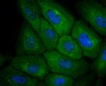 CXCR3 Antibody in Immunocytochemistry (ICC/IF)