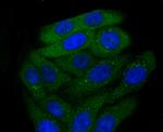 CXCR3 Antibody in Immunocytochemistry (ICC/IF)